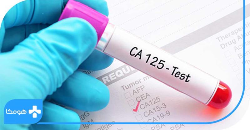 آزمایش CA125 چیست + تشخیص سرطان تخمدان!